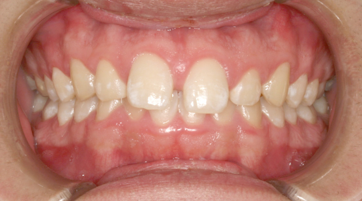 Before picture of treatment