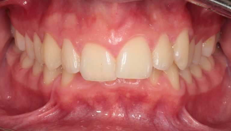 Before picture of treatment