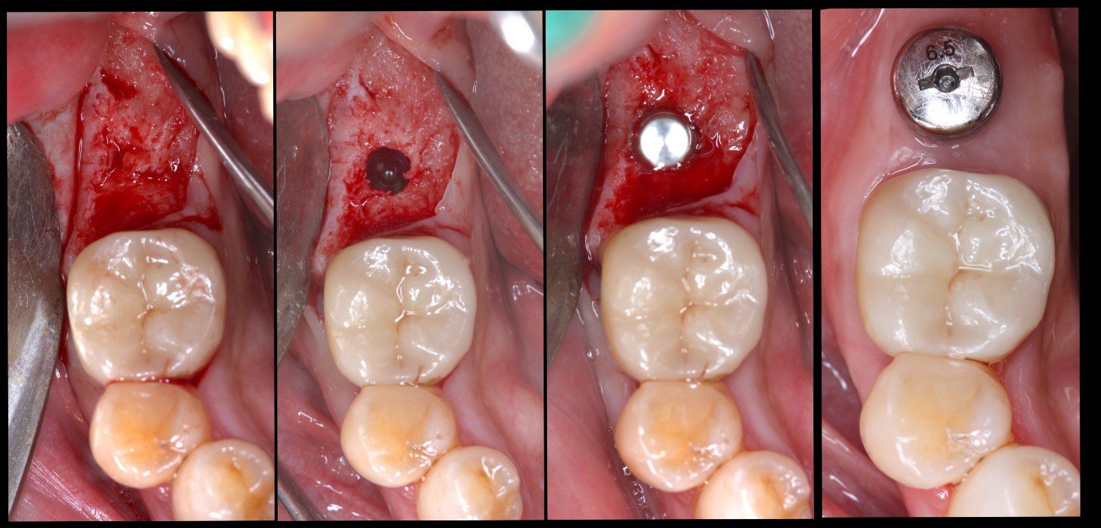 Highlighted picture of treatment